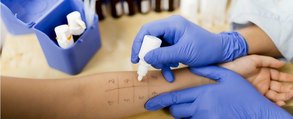 Alerjilerde görülen yoğun artış ile antibiyotikler arasında ilişki olabilir