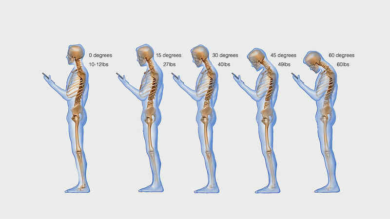 Aşırı telefon kullanımı boyna nasıl zarar veriyor?