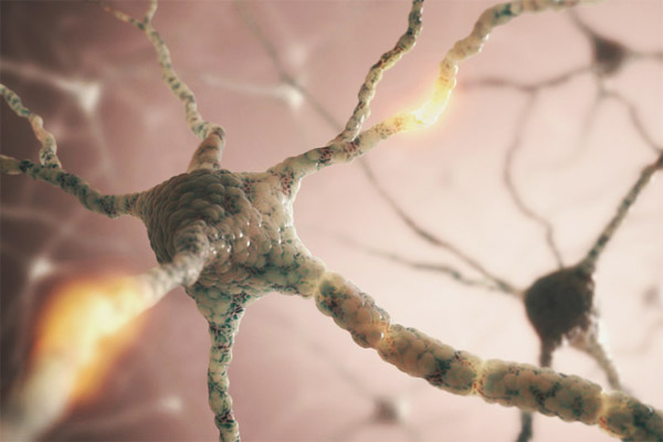 Alzheimer’ın nedenlerinden biri genç beyinlerde bulundu