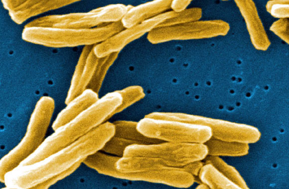 Dünya’da 1 trilyon mikrobiyal türün yaşadığını tahmin ediliyor